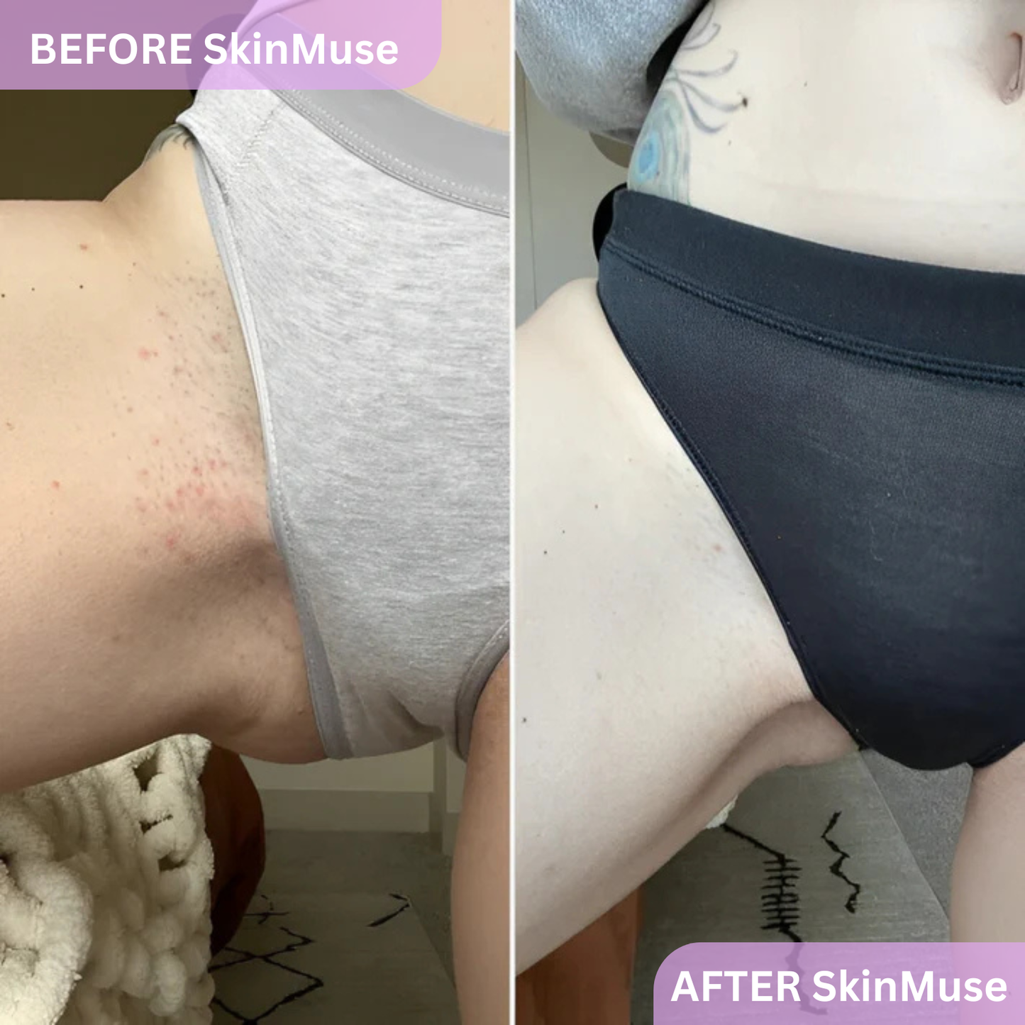 SkinMuse™ - 2in1 Shaver For Sensitive Skin